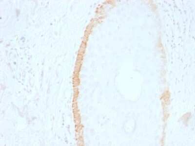 Immunohistochemistry-Paraffin: Cytokeratin 15 Antibody (SPM190) [NBP2-53313]