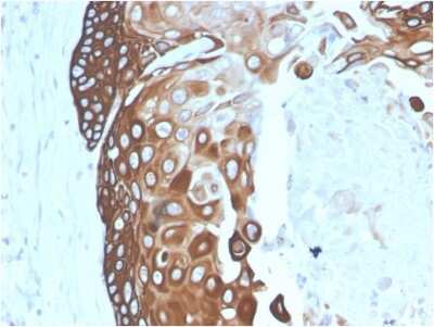 Immunohistochemistry-Paraffin: Cytokeratin 15 Antibody (SPM190) [NBP2-53313]
