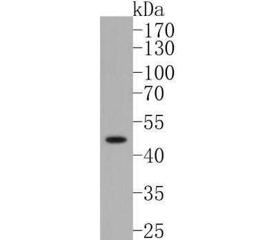 Western Blot: Cytokeratin 15 Antibody (ST04-85) [NBP2-67525]
