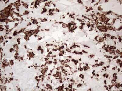 Immunohistochemistry: Cytokeratin 16 Antibody (OTI2H8) [NBP2-45538]