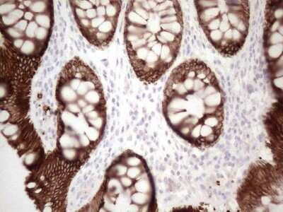 Immunohistochemistry: Cytokeratin 16 Antibody (OTI2H8) [NBP2-45538]