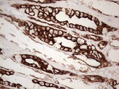 Immunohistochemistry: Cytokeratin 16 Antibody (OTI2H8) [NBP2-45538]
