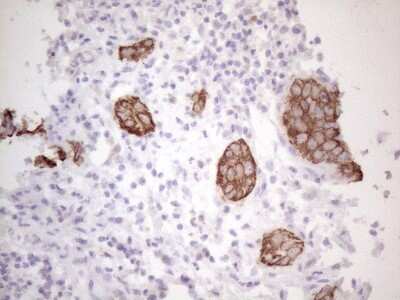 Immunohistochemistry: Cytokeratin 16 Antibody (OTI2H8) [NBP2-45538]