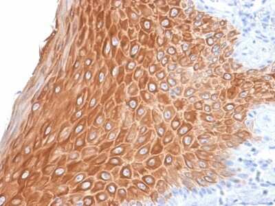 Immunohistochemistry-Paraffin: Cytokeratin 16 Antibody (KRT16/2043R) [NBP3-07681]