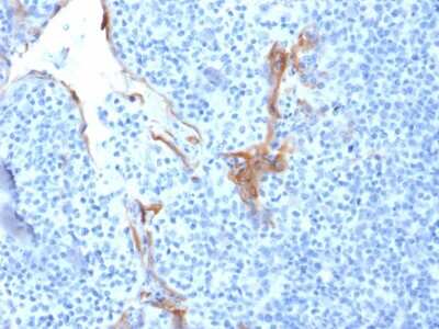 Immunohistochemistry-Paraffin: Cytokeratin 16 Antibody (LL025) [NBP3-07647]