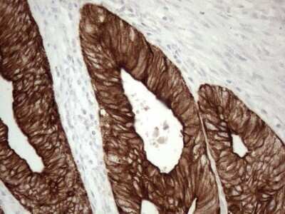 Immunohistochemistry: Cytokeratin 16 Antibody (OTI2H8) - Azide and BSA Free [NBP2-71085]