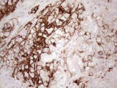 Immunohistochemistry: Cytokeratin 16 Antibody (OTI2H8) - Azide and BSA Free [NBP2-71085]