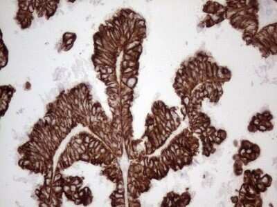 Immunohistochemistry: Cytokeratin 16 Antibody (OTI2H8) - Azide and BSA Free [NBP2-71085]