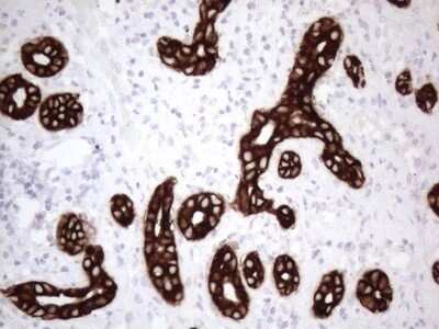 Immunohistochemistry: Cytokeratin 16 Antibody (OTI2H8) - Azide and BSA Free [NBP2-71085]