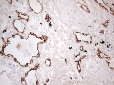 Immunohistochemistry: Cytokeratin 16 Antibody (OTI2H8) - Azide and BSA Free [NBP2-71085]