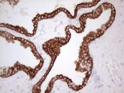 Immunohistochemistry: Cytokeratin 16 Antibody (OTI2H8) - Azide and BSA Free [NBP2-71085]