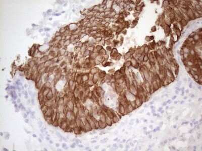 Immunohistochemistry: Cytokeratin 16 Antibody (OTI2H8) - Azide and BSA Free [NBP2-71085]