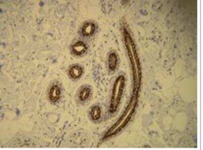 Immunohistochemistry-Paraffin: Cytokeratin 16 Antibody (R20-S) [NBP1-79070]
