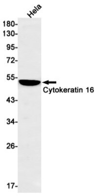 Western Blot: Cytokeratin 16 Antibody (S02-5F8) [NBP3-19530]