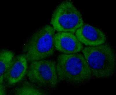 Immunocytochemistry/ Immunofluorescence: Cytokeratin 16 Antibody (SC52-09) [NBP2-67559]