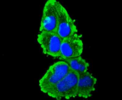 Immunocytochemistry/ Immunofluorescence: Cytokeratin 16 Antibody (SC52-09) [NBP2-67559]