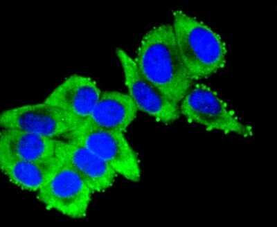 Immunocytochemistry/ Immunofluorescence: Cytokeratin 16 Antibody (SC52-09) [NBP2-67559]