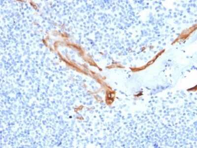 Immunohistochemistry-Paraffin: Cytokeratin 16 Antibody (SPM264) [NBP3-07649]