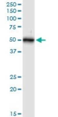 Western Blot: Cytokeratin 16 Antibody [H00003868-D01P]