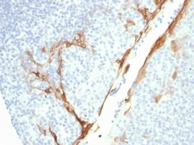 Immunohistochemistry-Paraffin: Cytokeratin 16 Antibody (rKRT16/1714) [NBP3-07680]