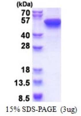 SDS-PAGE: Recombinant Human Cytokeratin 16 His Protein [NBP2-51613]