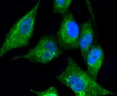 Immunocytochemistry/ Immunofluorescence: Cytokeratin 17/36 Antibody (SR45-06) [NBP2-67318]