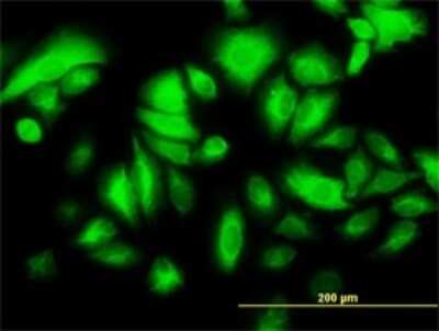 Immunocytochemistry/ Immunofluorescence: Cytokeratin 17 Antibody (2D4-1G9) [H00003872-M01]