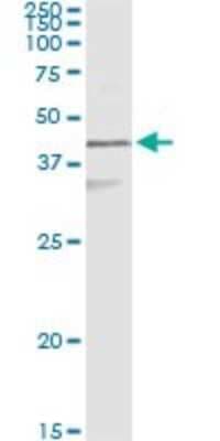 Immunoprecipitation: Cytokeratin 17 Antibody (2D4-1G9) [H00003872-M01]