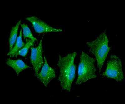 Immunocytochemistry/ Immunofluorescence: Cytokeratin 17 Antibody (9F3) - BSA Free [NBP2-42619]