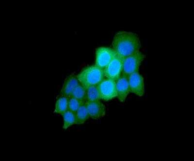 Immunocytochemistry/ Immunofluorescence: Cytokeratin 17 Antibody (9F3) - BSA Free [NBP2-42619]