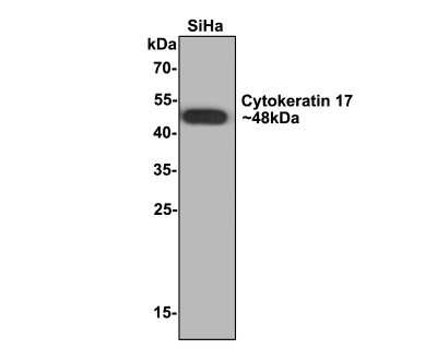 Western Blot: Cytokeratin 17 Antibody (A2B10) [NBP2-89123]