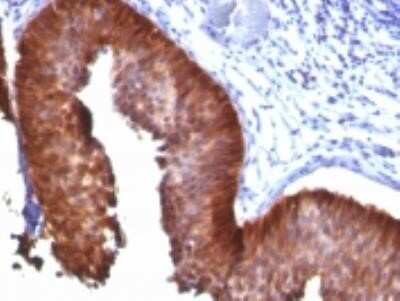 Immunohistochemistry-Paraffin: Cytokeratin 17 Antibody (E3 (same as Ks17.E3)) - Azide and BSA Free [NBP2-33188]