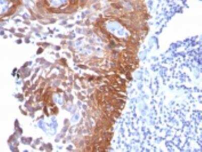 Immunohistochemistry-Paraffin: Cytokeratin 17 Antibody (E3 (same as Ks17.E3)) [NBP2-29421]