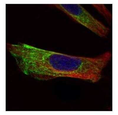 Immunocytochemistry/ Immunofluorescence: Cytokeratin 17 Antibody [NBP1-32824]