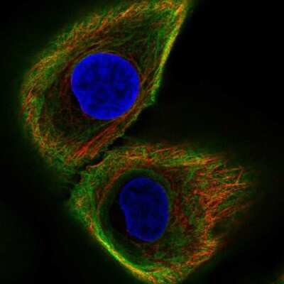 Immunocytochemistry/ Immunofluorescence: Cytokeratin 17 Antibody [NBP1-87320]