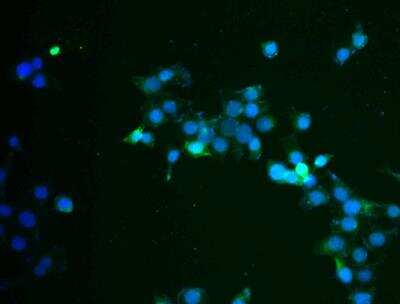 Immunocytochemistry/ Immunofluorescence: Cytokeratin 17 Antibody [NBP2-38536]