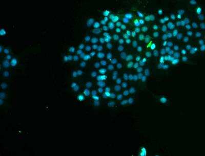Immunocytochemistry/ Immunofluorescence: Cytokeratin 17 Antibody [NBP2-38536]