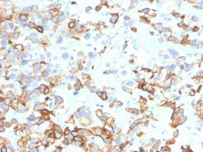 Immunohistochemistry-Paraffin: Cytokeratin 17 Antibody (KRT17/4604) [NBP3-07682]