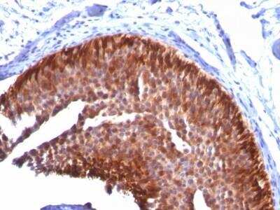 Immunohistochemistry-Paraffin: Cytokeratin 17 Antibody (KRT17/778) - Azide and BSA Free [NBP2-47684]