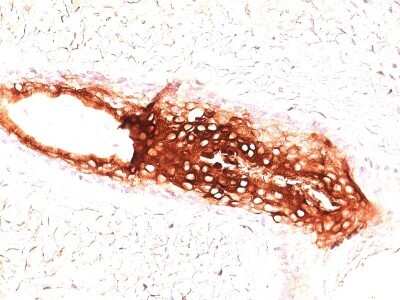 Immunohistochemistry-Paraffin: Cytokeratin 17 Antibody (SPM560) - Azide and BSA Free [NBP2-34425]