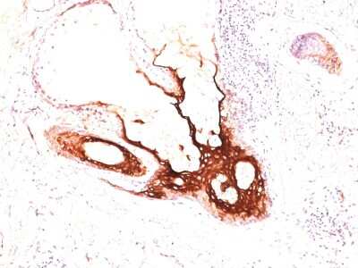 Immunohistochemistry-Paraffin: Cytokeratin 17 Antibody (SPM560) [NBP2-34378]