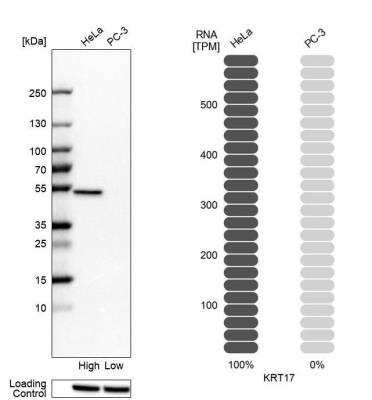 Western Blot: Cytokeratin 17 Antibody [NBP2-38536]