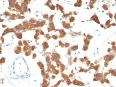 Immunohistochemistry-Paraffin: Cytokeratin 18 Antibody (B23.1) [NBP2-44952]