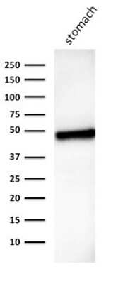 Western Blot: Cytokeratin 18 Antibody (B23.1) [NBP2-44952]