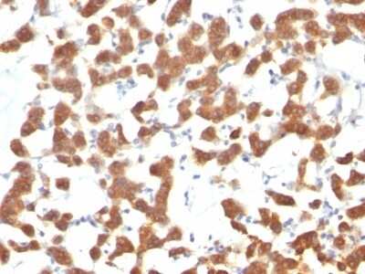 Immunohistochemistry-Paraffin: Cytokeratin 18 Antibody (C-04 (same as Ks18.04)) [NBP2-44951]