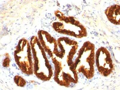 Immunohistochemistry-Paraffin: Cytokeratin 18 Antibody (Cocktail) - Azide and BSA Free [NBP2-47978]