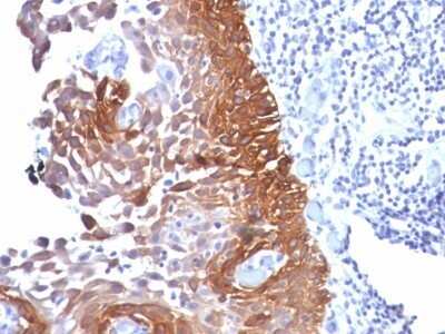 Immunohistochemistry-Paraffin: Cytokeratin 18 Antibody (Cocktail) [NBP2-44907]