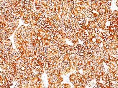 Immunohistochemistry-Paraffin: Cytokeratin 18 Antibody (Cocktail) [NBP2-44907]