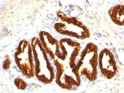 Immunohistochemistry-Paraffin: Cytokeratin 18 Antibody (Cocktail) [NBP2-44907]