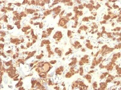 Immunohistochemistry-Paraffin: Cytokeratin 18 Antibody (Cocktail) [NBP2-44907]